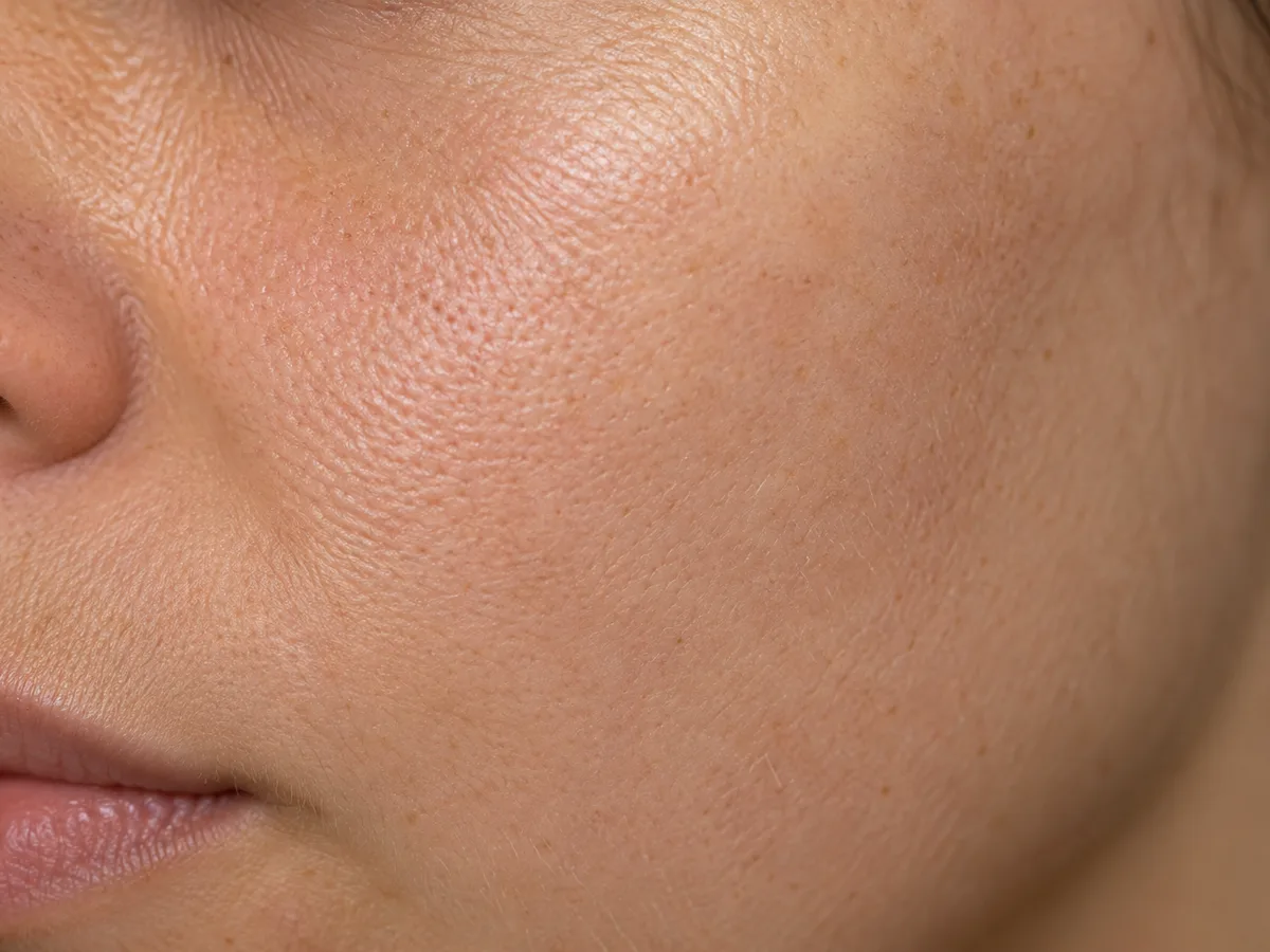 Close-up of cheek skin beside the nose and lips showing fine pores and texture
